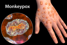 猴痘检测试剂盒龙头股票有哪些?猴痘检测试剂盒概念股票名单一览表-小李财经视角