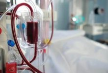 血液透析龙头股票有哪些？血液透析概念股票名单一览表-小李财经视角