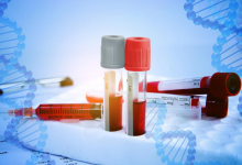 血液制品龙头股票有哪些?血液制品概念股票名单一览表-小李财经视角