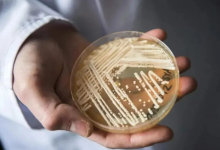 超级真菌龙头股票有哪些?超级真菌概念股票名单一览表-小李财经视角